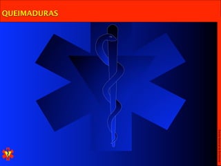 Escola Nacional de Bombeiros
QUEIMADURAS
 