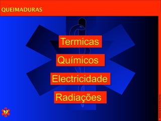 QUEIMADURAS




               Termicas
               Químicos
              Electricidade
              Radiações




                              Escola Nacional de Bombeiros
 