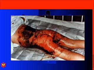 Escola Nacional de Bombeiros
 