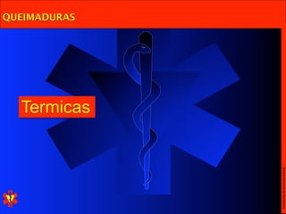 Escola Nacional de Bombeiros
              Termicas
QUEIMADURAS
 