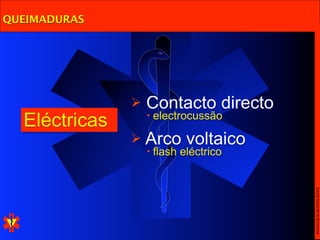 QUEIMADURAS




                  Contacto directo
  Eléctricas       •   electrocussão

                Arco         voltaico
                   •   flash eléctrico




                                         Escola Nacional de Bombeiros
 
