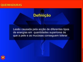 QUEIMADURAS


                     Definição


      Lesão causada pela acção de diferentes tipos
      de energias em quantidades superiores às
      que a pele e as mucosas conseguem tolerar




                                                     Escola Nacional de Bombeiros
 