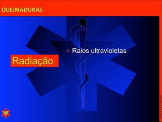 QUEIMADURAS




                 Raios ultravioletas
  Radiação




                                        Escola Nacional de Bombeiros
 