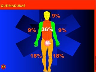 QUEIMADURAS


                         9%

              9%   36%    9%

                    1%



              18%        18%




                               Escola Nacional de Bombeiros
 