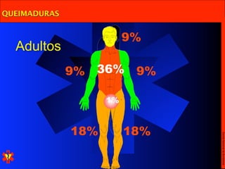 QUEIMADURAS


                         9%
  Adultos
              9%   36%    9%

                    1%



              18%        18%




                               Escola Nacional de Bombeiros
 