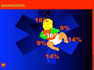 Escola Nacional de Bombeiros
                     14%
                9%
                      36%


                            14%
              18%


                    9%
QUEIMADURAS
 