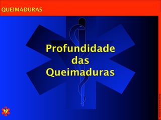 QUEIMADURAS




              Profundidade
                   das
              Queimaduras




                             Escola Nacional de Bombeiros
 