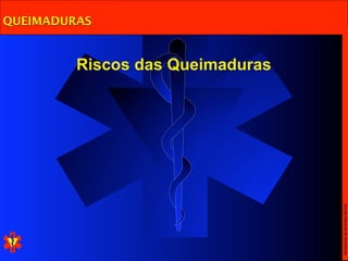 QUEIMADURAS


         Riscos das Queimaduras




                                  Escola Nacional de Bombeiros
 
