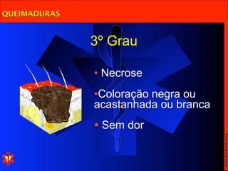 QUEIMADURAS


              3º Grau

              • Necrose
              •Coloração negra ou
              acastanhada ou branca
              • Sem dor




                                      Escola Nacional de Bombeiros
 