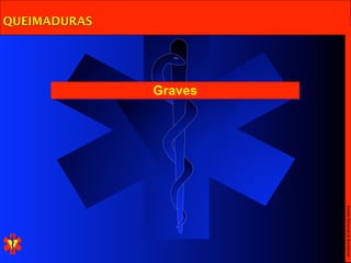 Escola Nacional de Bombeiros
              Graves
QUEIMADURAS
 