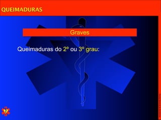 QUEIMADURAS



                      Graves

    Queimaduras do 2º ou 3º grau:




                                    Escola Nacional de Bombeiros
 
