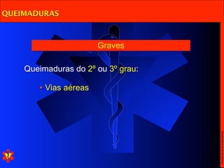 QUEIMADURAS



                       Graves

    Queimaduras do 2º ou 3º grau:

       • Vias aéreas




                                    Escola Nacional de Bombeiros
 