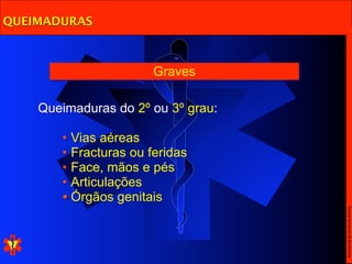 QUEIMADURAS



                       Graves

    Queimaduras do 2º ou 3º grau:

       • Vias aéreas
       • Fracturas ou feridas
       • Face, mãos e pés
       • Articulações
       • Órgãos genitais




                                    Escola Nacional de Bombeiros
 