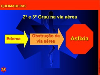 QUEIMADURAS


          2º e 3º Grau na via aérea


              Obstrução da
  Edema
               via aérea        Asfixia




                                          Escola Nacional de Bombeiros
 