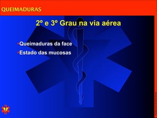 QUEIMADURAS

          2º e 3º Grau na via aérea

    •Queimaduras da face
    •Estado das mucosas




                                      Escola Nacional de Bombeiros
 