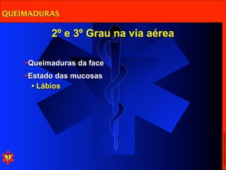 QUEIMADURAS

          2º e 3º Grau na via aérea

    •Queimaduras da face
    •Estado das mucosas
     • Lábios




                                      Escola Nacional de Bombeiros
 