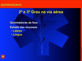 QUEIMADURAS

          2º e 3º Grau na via aérea

    •Queimaduras da face
    •Estado das mucosas
     • Lábios
     • Língua




                                      Escola Nacional de Bombeiros
 