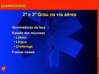 QUEIMADURAS

          2º e 3º Grau na via aérea

    •Queimaduras da face
    •Estado das mucosas
     • Lábios
     • Língua
     • Orofaringe
    •Fossas nasais




                                      Escola Nacional de Bombeiros
 