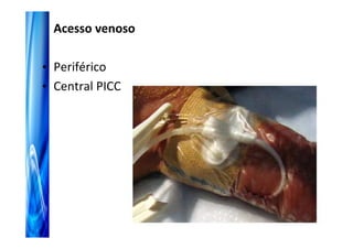 Acesso venoso

• Periférico
• Central PICC
 