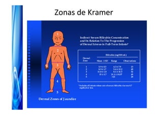 Zonas de Kramer

            1
                             Indirect Serum Bilirubin Concentration
                             and Its Relation To The Progression
                             of Dermal Icterus in Full-Term Infants*

            2
                                                            Bilirubin (mg/100 mL)
                                 Dermal
                                 Zone            Mean ± SD         Range          Observations

    5       3      5                1              5.9 ± 0.3         4.3 ± 7.9            13
                                    2              8.9 ± 1.7         5.4 ± 12.2           49
                                    3             11.8 ± 1.8         8.1 ± 16.5           52
                                    4               15 ± 1.7       11.1 ± 18.37           45
                                    5                               >15                   29

            4
                            *Includes all infants whose rate of serum bilirubin rise was 0.7
                             mg/dL /h or less.

            5

Dermal Zones of J aundice
 