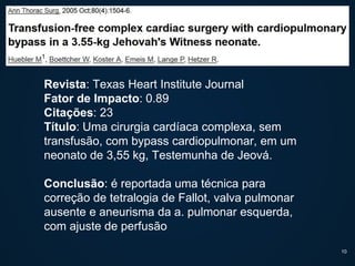 Revista: Texas Heart Institute Journal
Fator de Impacto: 0.89
Citações: 23
Título: Uma cirurgia cardíaca complexa, sem
transfusão, com bypass cardiopulmonar, em um
neonato de 3,55 kg, Testemunha de Jeová.
Conclusão: é reportada uma técnica para
correção de tetralogia de Fallot, valva pulmonar
ausente e aneurisma da a. pulmonar esquerda,
com ajuste de perfusão
10
 