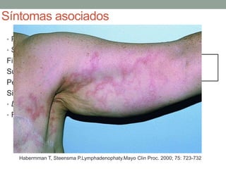 abordaje-adenopatias-pptx