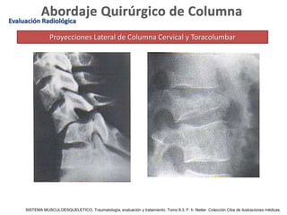 Evaluación Radiológica
Proyecciones Lateral de Columna Cervical y Toracolumbar
SISTEMA MUSCULOESQUELETICO. Traumatología, evaluación y tratamiento. Tomo 8.3. F: h: Netter. Colección Ciba de ilustraciones médicas.
 