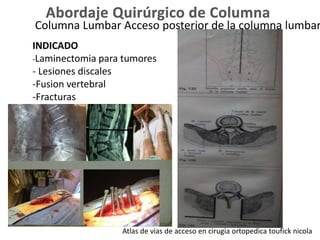 Columna Lumbar Acceso posterior de la columna lumbar
INDICADO
-Laminectomia para tumores
- Lesiones discales
-Fusion vertebral
-Fracturas
Atlas de vias de acceso en cirugia ortopedica toufick nicola
 
