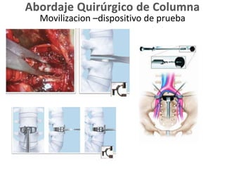 Movilizacion –dispositivo de prueba
 