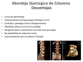 Desventajas
• Curva de aprendizaje
• Entrenamiento microquirurgico limitado a L2-S1
• Limitado a patologia mono o bisegmentarias
• Abordajes lateral a L5-S1 no es posible
• Riesgo de lesion a estructuras cerca del area quirurgica
• No posibilidad de reduccion activa
• Instrumentacion por via anterior limitada
 