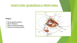 DISECCIÓN QUIRÚRGICA PROFUNDA
Peligros:
 Nervio glúteo superior.
 Nervio femoral.
 Vena y arteria femorales.
 Arteria circunfleja lateral
 