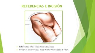 REFERENCIAS E INCISIÓN
 Referencias: EIAS / Cresta iliaca subcutáneas.
 Incisión: ½ anterior Cresta iliaca  EIAS  Curva abajo 8 – 10cm.
 