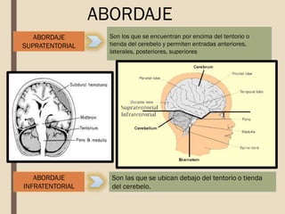 Son los que se encuentran por encima del tentorio o
tienda del cerebelo y permiten entradas anteriores,
laterales, posteriores, superiores
ABORDAJE
SUPRATENTORIAL
ABORDAJE
INFRATENTORIAL
Son las que se ubican debajo del tentorio o tienda
del cerebelo.
ABORDAJE
 