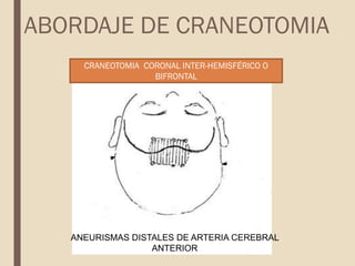 CRANEOTOMIA CORONAL INTER-HEMISFÉRICO O
BIFRONTAL
ANEURISMAS DISTALES DE ARTERIA CEREBRAL
ANTERIOR
ABORDAJE DE CRANEOTOMIA
 