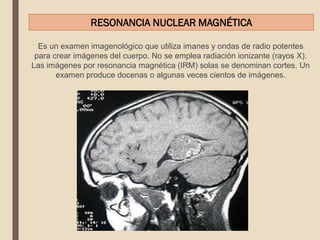 Es un examen imagenológico que utiliza imanes y ondas de radio potentes
para crear imágenes del cuerpo. No se emplea radiación ionizante (rayos X).
Las imágenes por resonancia magnética (IRM) solas se denominan cortes. Un
examen produce docenas o algunas veces cientos de imágenes.
RESONANCIA NUCLEAR MAGNÉTICA
 