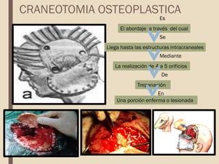 CRANEOTOMIA OSTEOPLASTICA
Es
El abordaje a través del cual
Se
Llega hasta las estructuras intracraneales
Mediante
La realización de 4 a 5 orificios
Trepanación
De
En
Una porción enferma o lesionada
 
