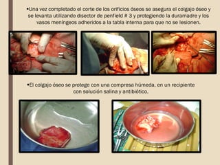 Una vez completado el corte de los orificios óseos se asegura el colgajo óseo y
se levanta utilizando disector de penfield # 3 y protegiendo la duramadre y los
vasos meníngeos adheridos a la tabla interna para que no se lesionen.
El colgajo óseo se protege con una compresa húmeda, en un recipiente
con solución salina y antibiótico.
 