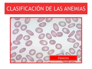 CLASIFICACIÓN DE LAS ANEMIAS




                  Eliptocitos
 