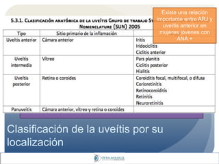 Clasificación de la uveítis por su
localización
En México
38% de uveítis anterior
26% de uveítis posterior
20% de uveítis intermedia
16% de panuveítis
La prevalencia 1984 era de 38 por cada 100,000 en población
general.
Incidencia anual 17 por cada 100,000, con una máxima incidencia
en el grupo de edad de 25 a 44 años.
(Groman-Lupa 2008, Voorduin 2005 Instituto de Oftalmología
Conde de Valenciana)
Existe una relación
importante entre ARJ y
uveítis anterior en
mujeres jóvenes con
ANA +
 