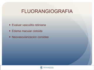 FLUORANGIOGRAFIA
 Evaluar vasculitis retiniana
 Edema macular cistoide
 Neovascularizacion coroidea
 