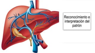 Reconocimiento e
interpretación del
patrón
 