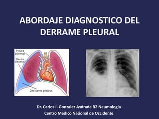 ABORDAJE DIAGNOSTICO DEL
DERRAME PLEURAL
Dr. Carlos I. Gonzalez Andrade R2 Neumologia
Centro Medico Nacional de Occidente
 
