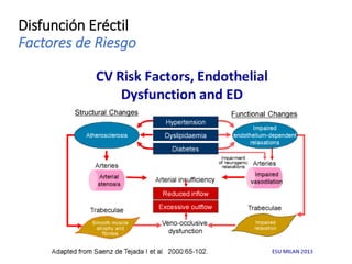 Disfunción Eréctil
Factores de Riesgo
 