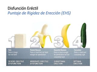 Disfunción Eréctil
Puntaje de Rigidez de Erección (EHS)
 