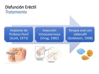 Disfunción Eréctil
Tratamiento
Implante de
Prótesis Penil
(Scott, 1973)
Inyección
Intracavernosa
(Virag, 1982)
Terapia oral con
sildenafil
(Goldstein, 1998)
 