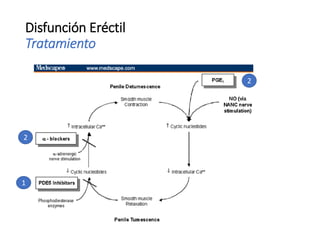 Disfunción Eréctil
Tratamiento
1
2
2
 