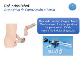 Disfunción Eréctil
Dispositivo de Constricción al Vacío
Banda de constricción por 30 min
Cambios en color y temperatura
de pene, reducción de
sensibilidad, dolor al eyacular
2
 