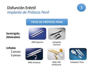 Disfunción Eréctil
Implante de Prótesis Penil
AMS Spectra Coloplast
Genesis
AMS Ambicor AMS 700
inhibizone
Coloplast Titan
TIPOS DE PRÓTESIS PENIL
Semirígida
(Maleable)
Inflable
2 piezas
3 piezas
3
 