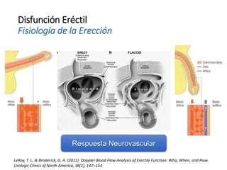 Disfunción Eréctil
Fisiología de la Erección
Respuesta Neurovascular
LeRoy, T. J., & Broderick, G. A. (2011). Doppler Blood Flow Analysis of Erectile Function: Who, When, and How.
Urologic Clinics of North America, 38(2), 147–154.
 