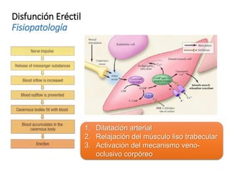 Disfunción Eréctil
Fisiopatología
1. Dilatación arterial
2. Relajación del músculo liso trabecular
3. Activación del mecanismo veno-
oclusivo corpóreo
 